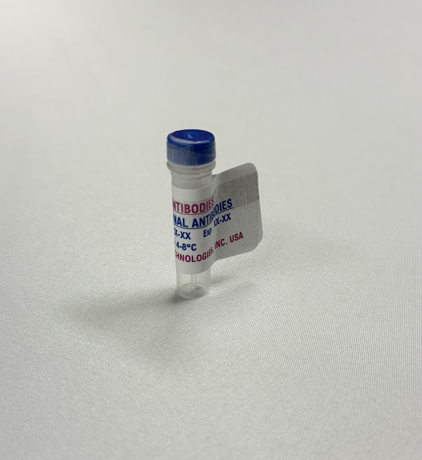 Established Antibody Pairs